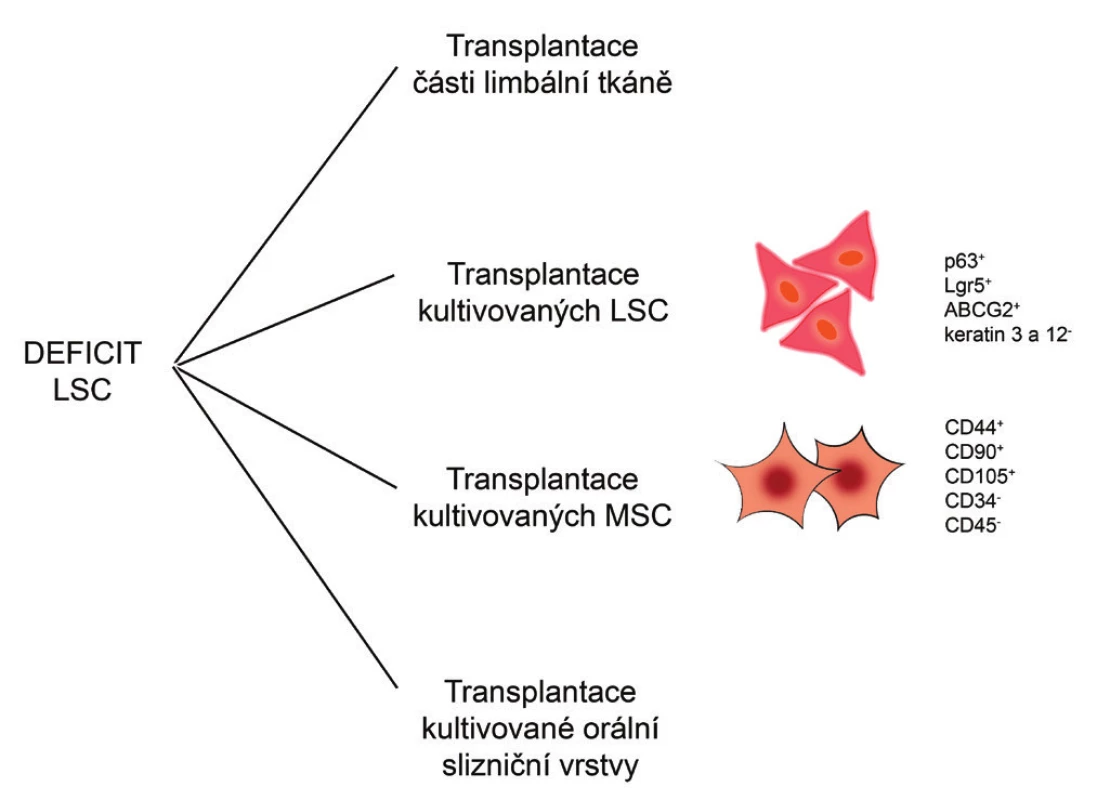 Možné terapeutické přístupy při léčbě deficitu LSC. Při léčbě deficitu LSC mohou být transplantovány části limbální tkáně nebo laboratorně kultivované LSC, MSC či orální slizniční vrstva