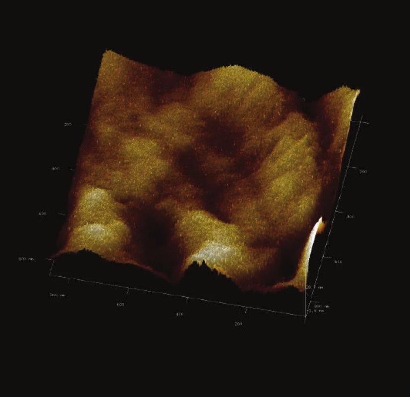 3-D zobrazení jemného detailu povrchové struktury magnetického nosiče P(HEMA-GMA)-NH<sub>2</sub>. Vložené měřítko odpovídá 100 nm. Skenovaná oblast 860x860 nm<sup>2</sup>, Z – rozsah 28 nm. 