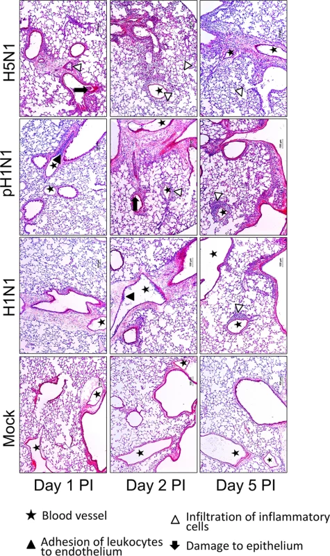 Representative pathological images of influenza-infected lungs.