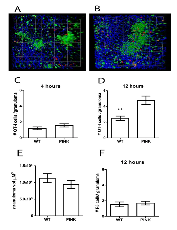 Accumulation of antigen-specific CD8<sup>+</sup> T cells within hepatic granulomas.