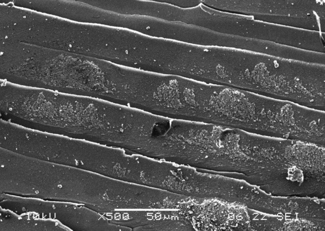 Detail plasticky přetvořeného adheziva iBond se zbytky kompozitního materiálu na jeho povrchu, zvětšeno 500x.