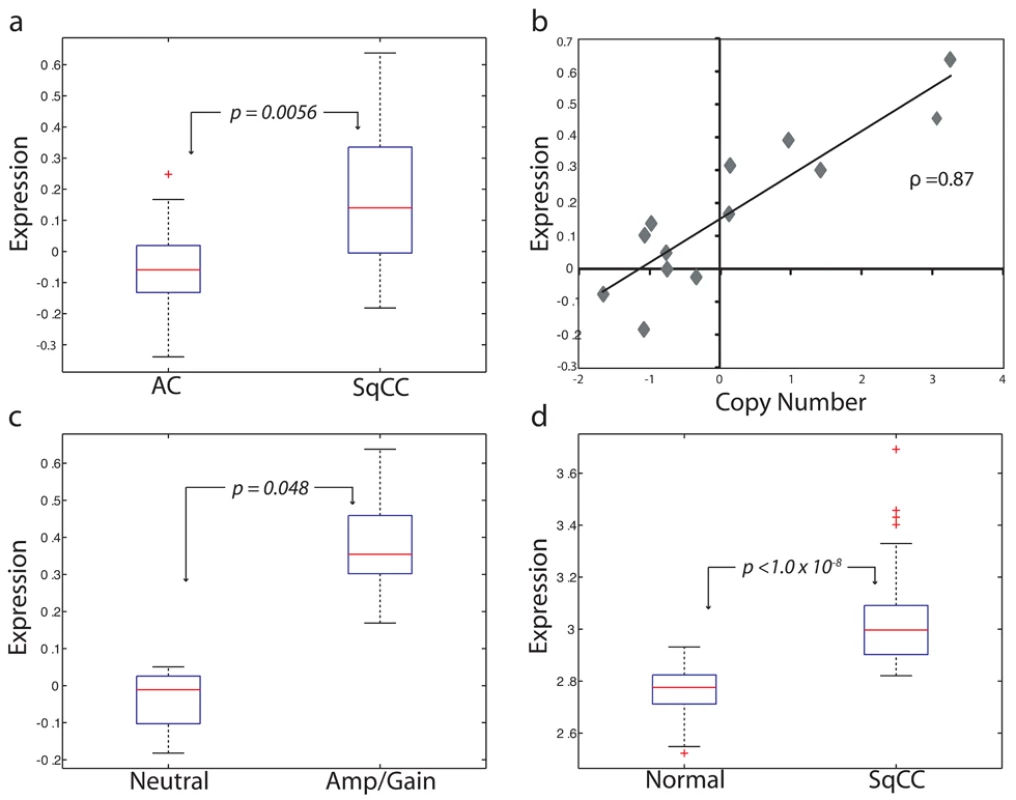<i>BRF2</i> is a lineage-specific oncogene targeted by amplification in SqCC.