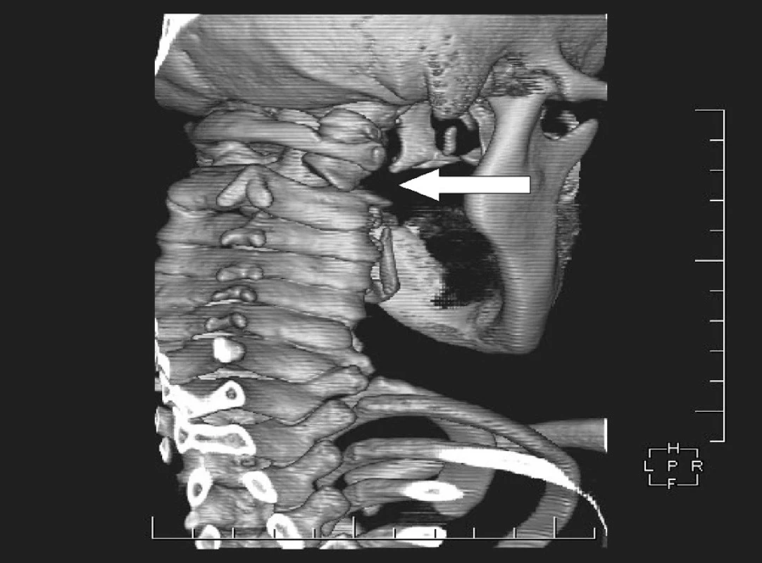 <br>Fig. 3.