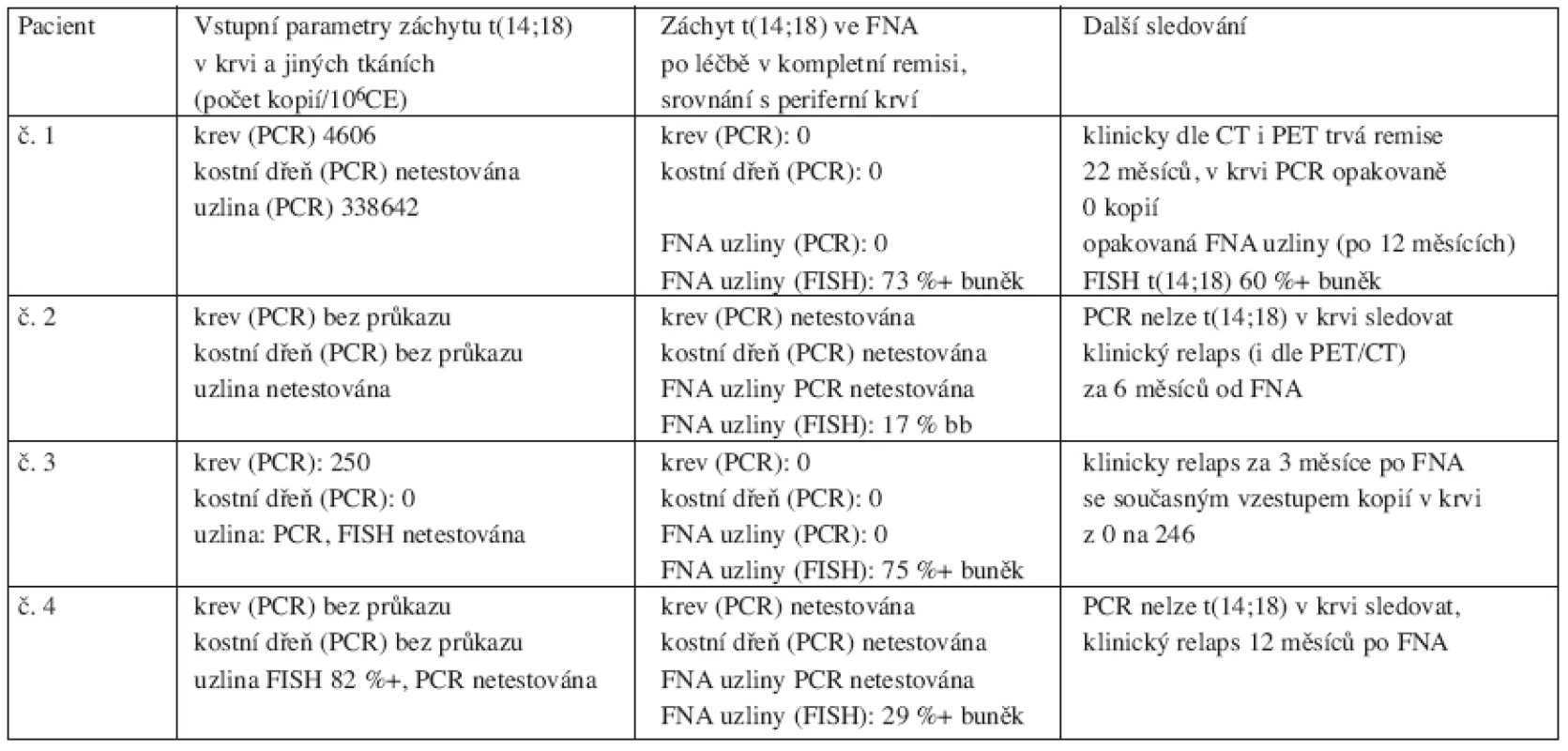 Přehled čtyř pacientů s průkazem t(14;18) ve FNA uzliny provedené po léčbě v době kompletní a molekulární remise.