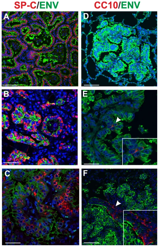 Phenotype of tumor cells in naturally occurring OPA.