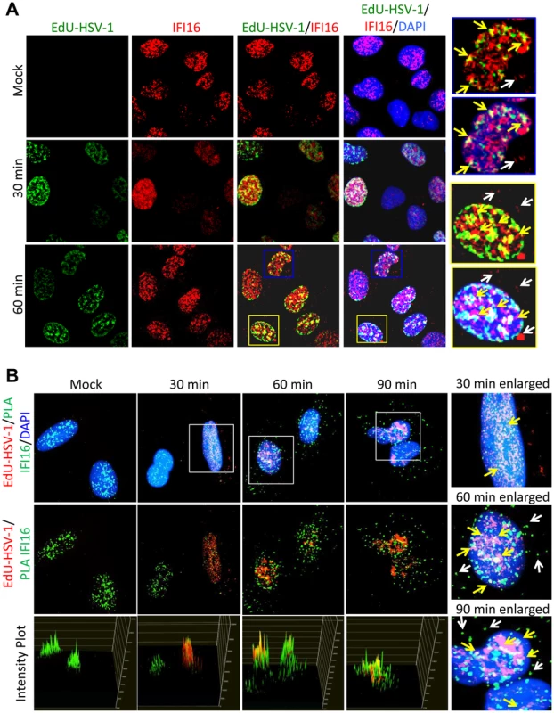 Analysis of HSV-1 genome entry into the nucleus and association with IFI16.