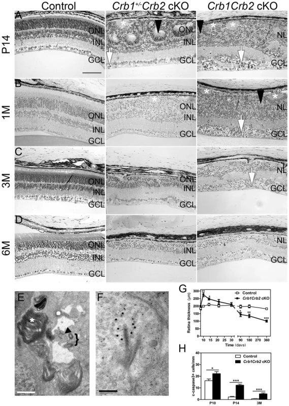 Abnormal layering in <i>Crb1Crb2</i> cKO retinas.