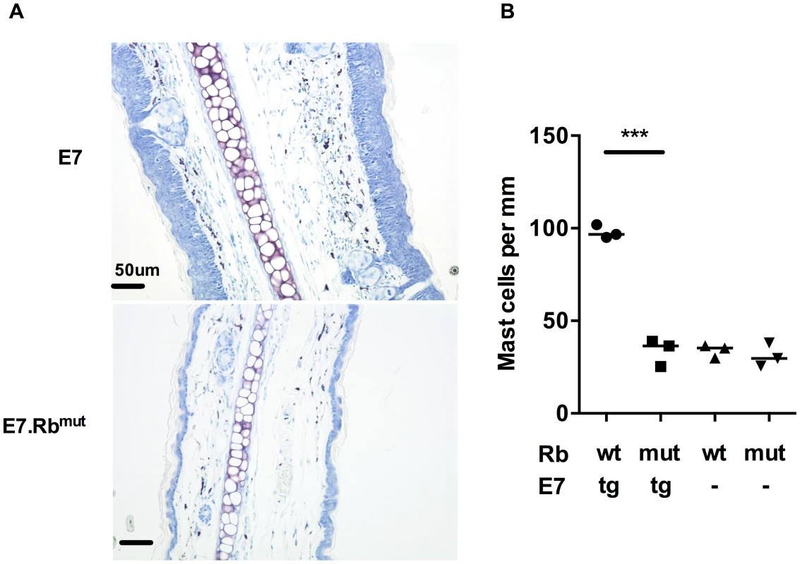 MC infiltration in ear skin is dependent on E7 hyperplasia.
