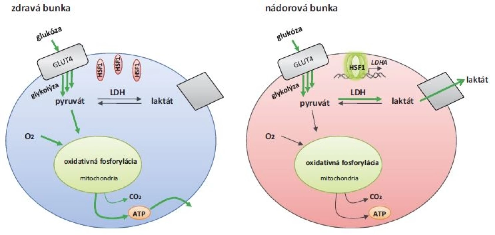 Metabolizmus glukózy v zdravých a nádorových bunkách. Nádorové bunky sú závislé na aeróbnej glykolýze (Warburgov
efekt) [64]. Zvýšená hladina HSF1 v nádorových bunkách indukuje syntézu laktát dehydrogenázy, ktorá katalyzuje premenu pyruvátu
na laktát [67].