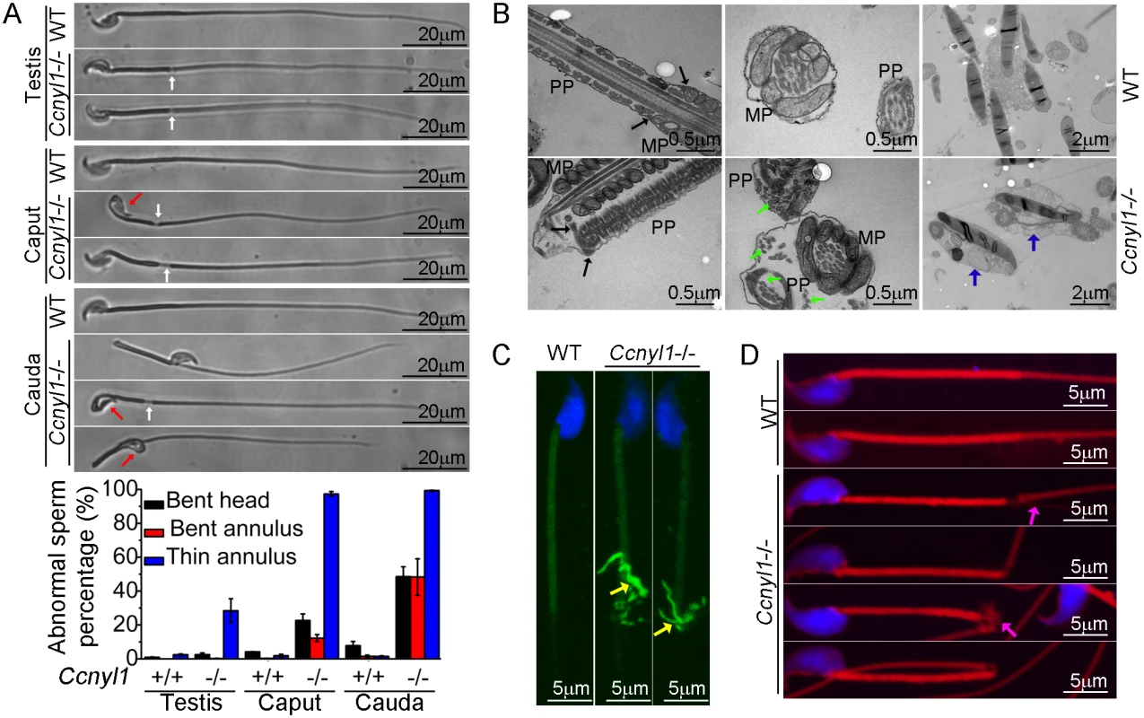 Morphological defects of <i>Ccnyl1</i>-/- spermatozoa.