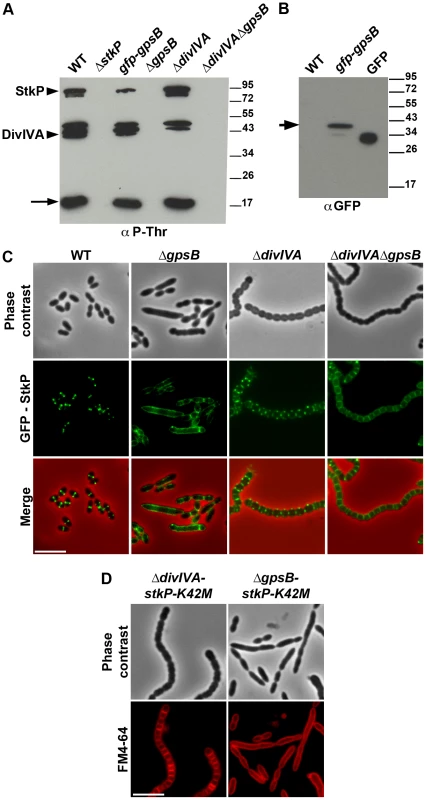 Interplay of GpsB, DivIVA and StkP.