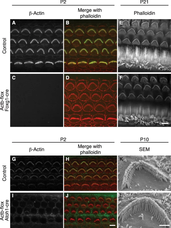 β-actin is not required for stereocilia formation.
