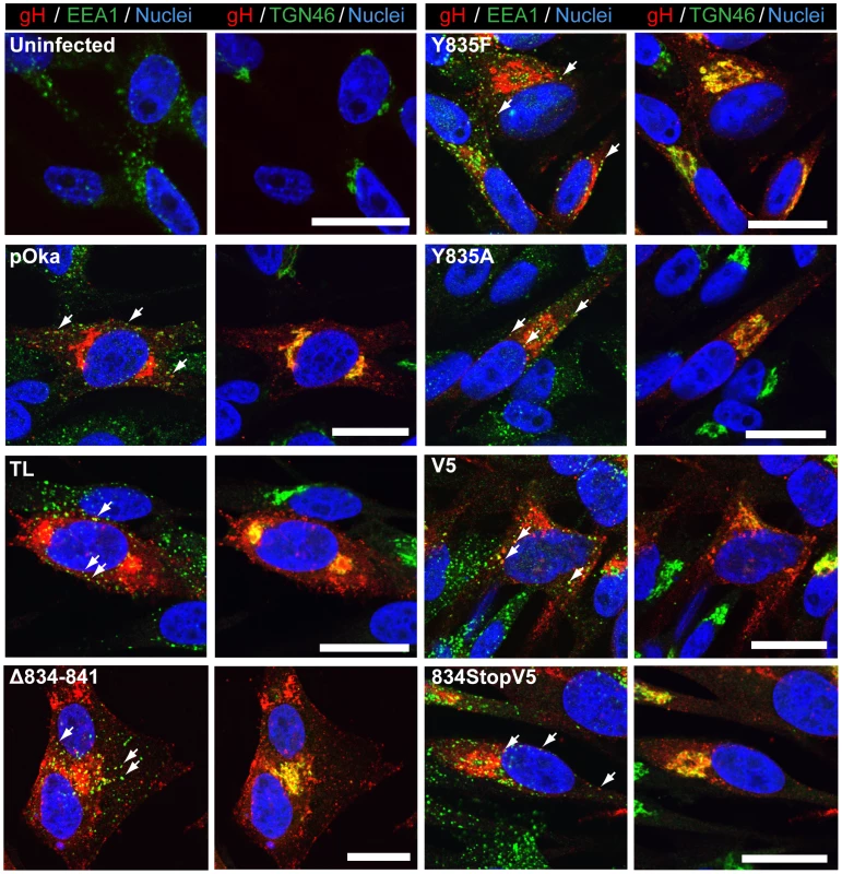 Amino acids 834-841 of the gHcyt are dispensable for intracellular trafficking and endocytosis of gH during infection of melanoma cells.