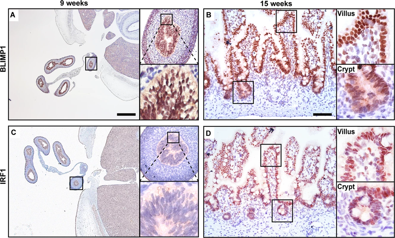 BLIMP1 and IRF1 are co-expressed in fetal human intestine.