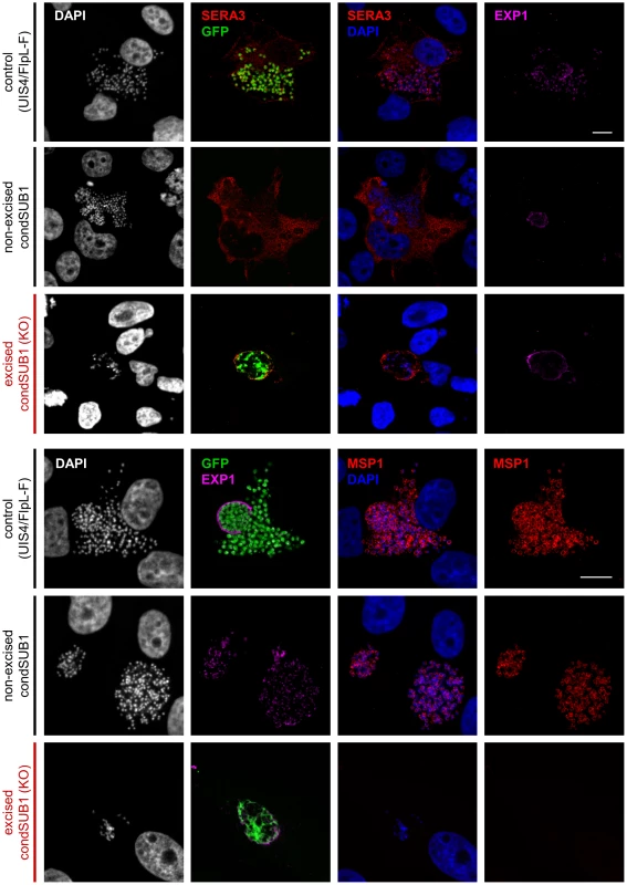 PbSUB1-deficient liver stage schizonts are defective in development.