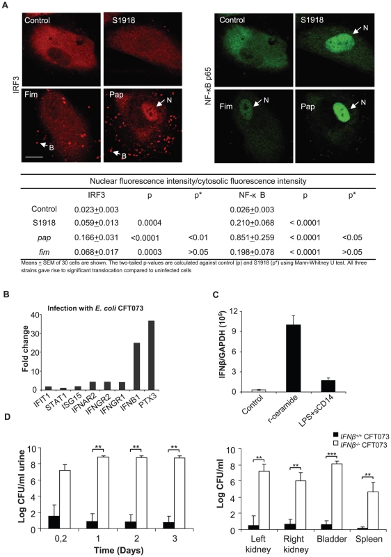 Nuclear IRF3 translocation after stimulation with P-fimbriated <i>E. coli</i> and the importance of IFN signaling for host resistance against UTI.