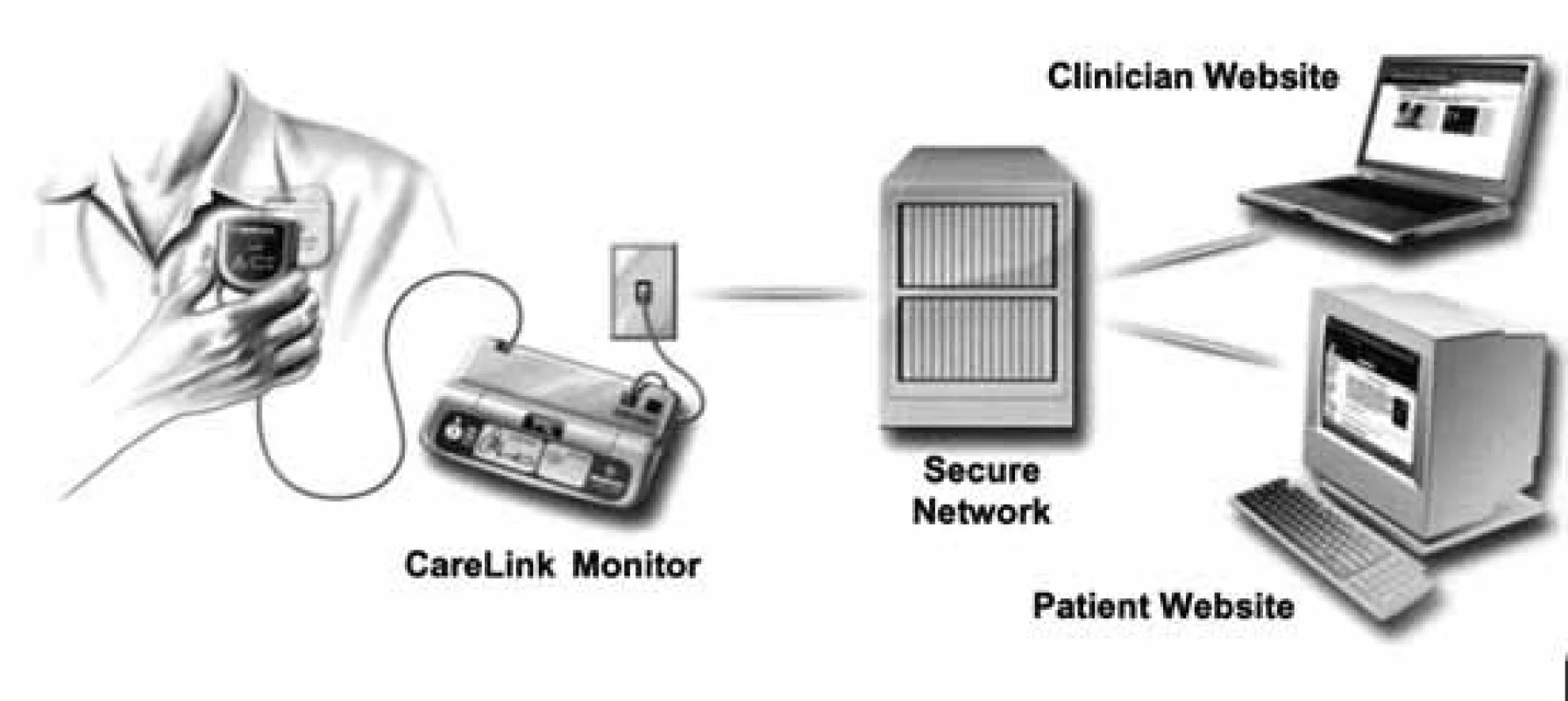 Princip systému Medtronic Carelink (převzato z Pacing Clin Electrophysiol 2004, Blackwell Publishing).