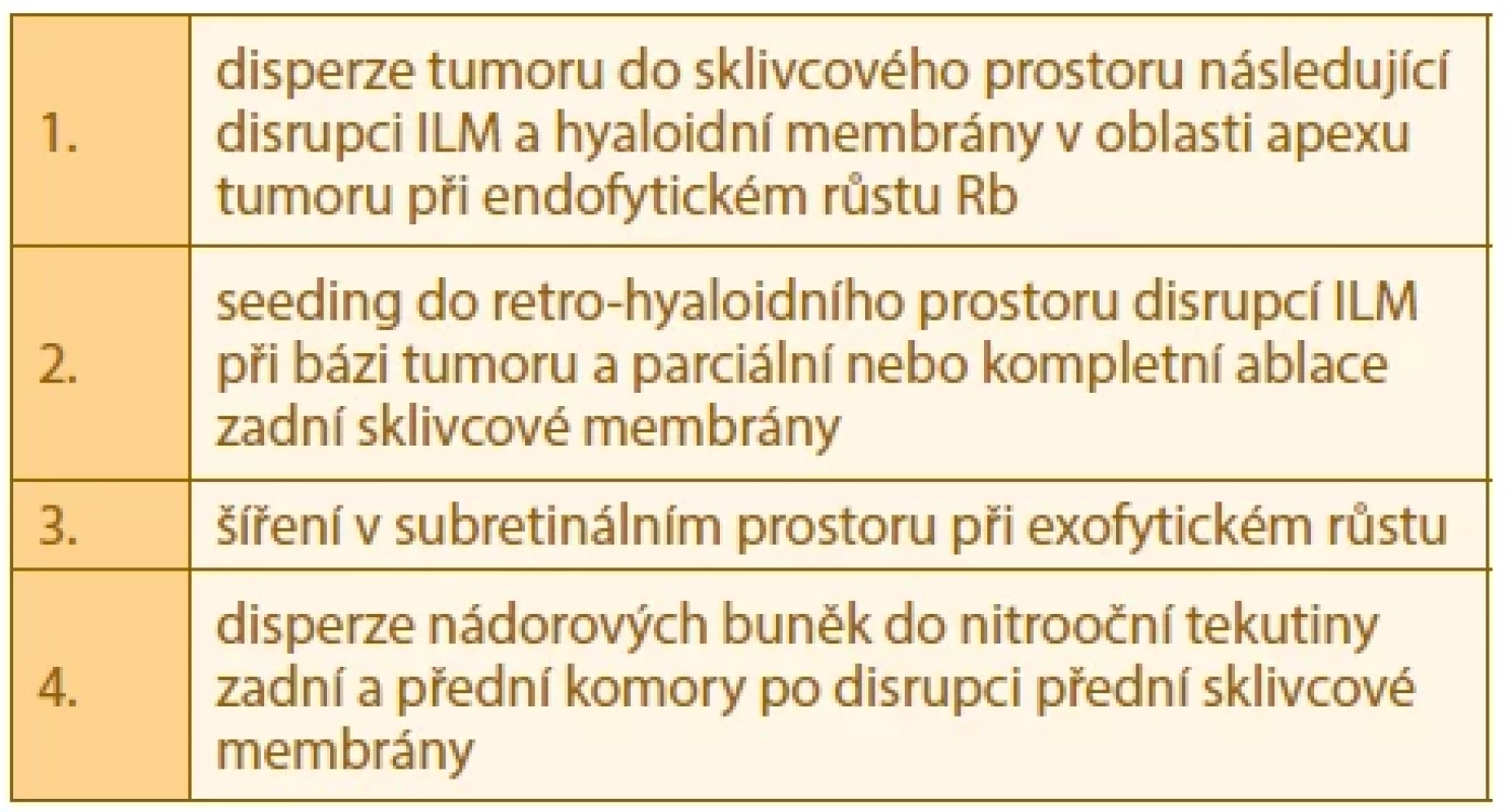 Four distinct anatomic sites of intraocular retinoblastoma [7]