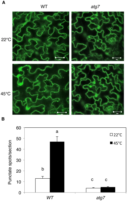 Determination of accumulation of autophagosomes using GFP-ATG8a.