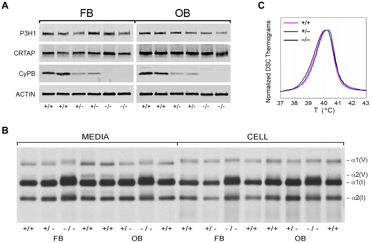 Synthesis of type I collagen.