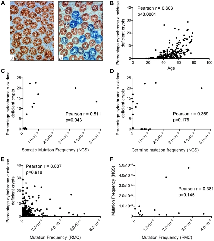 Quantification of mitochondrial dysfunction in human colonic crypts by cytochrome <i>c</i> oxidase (COX)/succinate dehydrogenase (SDH) histochemistry.