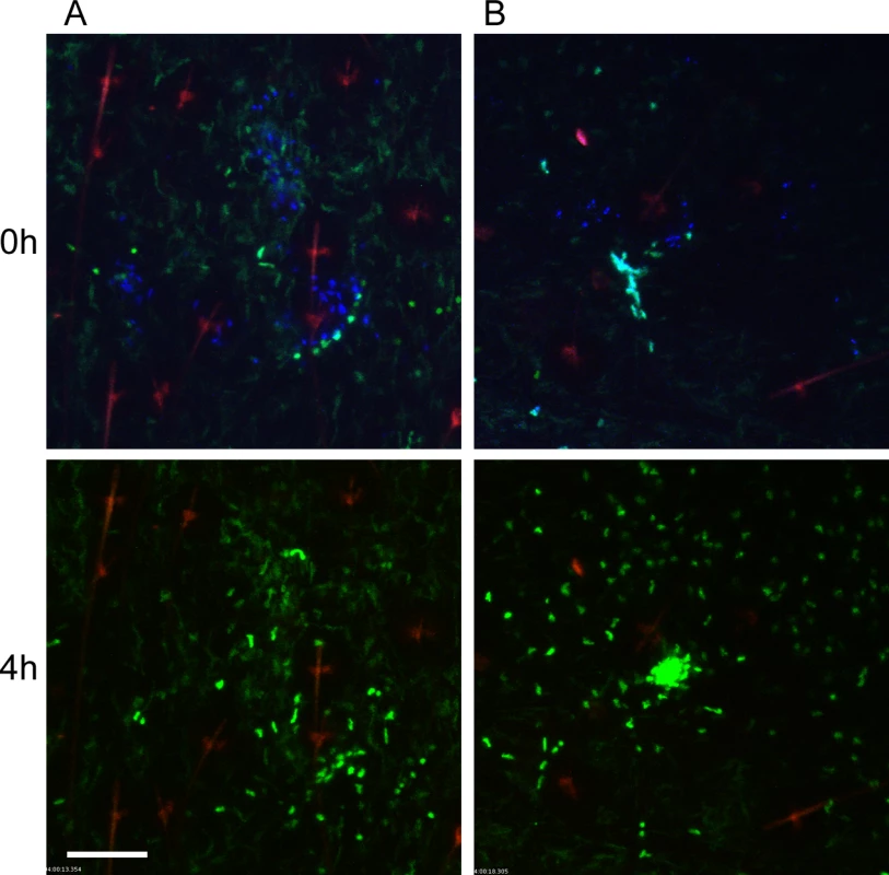 Responses of neutrophils and macrophages to blocked flea bites without transmission of <i>Y</i>. <i>pestis</i>.