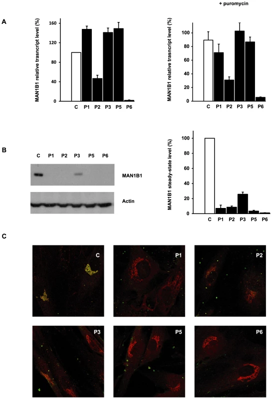 Functional analyses of <i>MAN1B1</i> mutations.