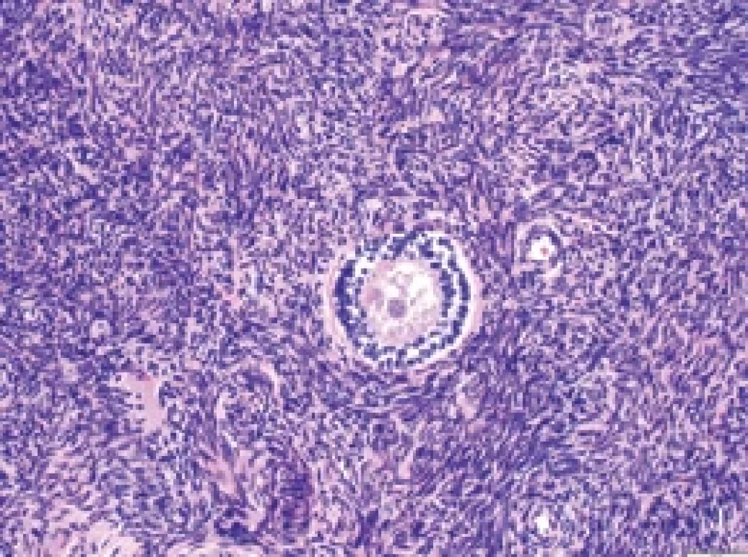 a. Histologický řez kortikální tkáně vaječníku před zamražením – primární folikl (barevní HE, 200×). Fig. 10a. Histological section of ovarian cortical tissue before cryopreservation – primary follicle (HE staining, 200×). HE – hematoxylin a eozin