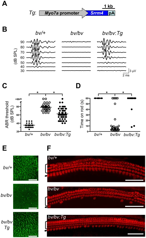 The bv phenotype is rescued by hair-cell targeted expression of an <i>Srrm4</i> transgene.