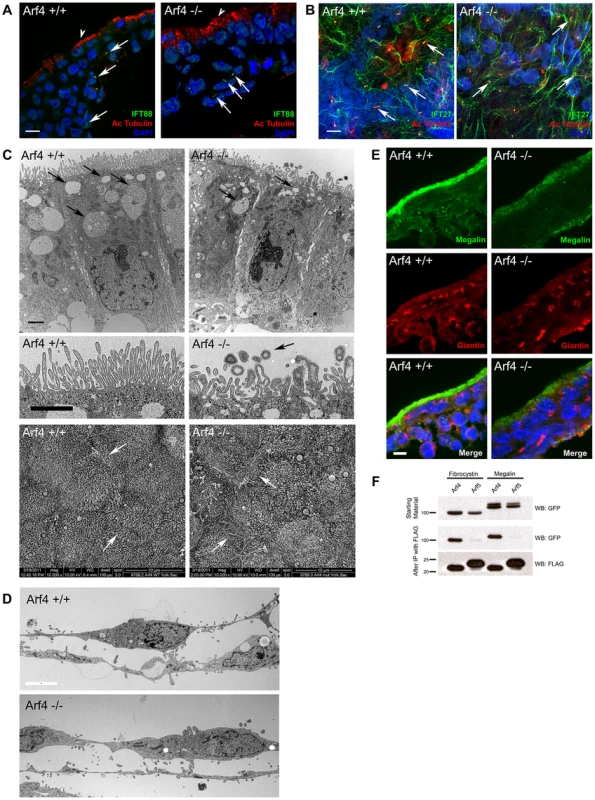 Arf4 mutant embryos have defects in the visceral endoderm.