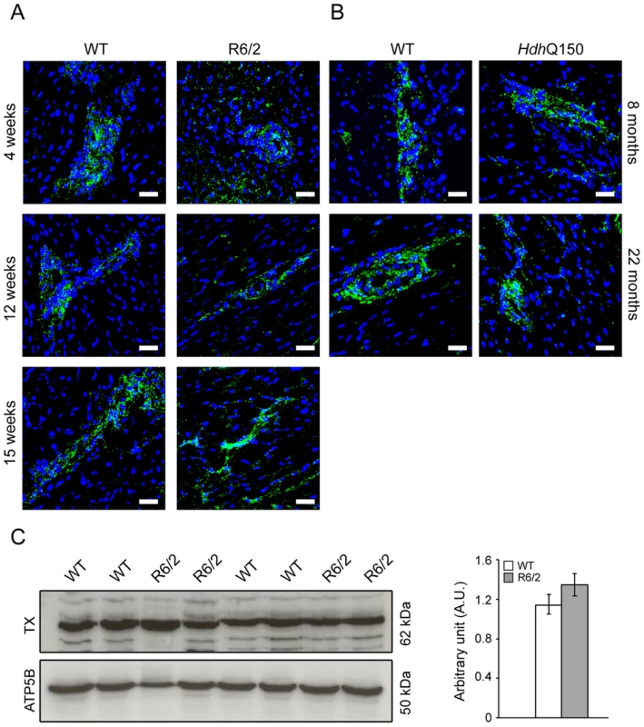 Architecture of altered ganglionic plexuses based on tyrosine hydroxylase localisation in HD mouse model hearts.