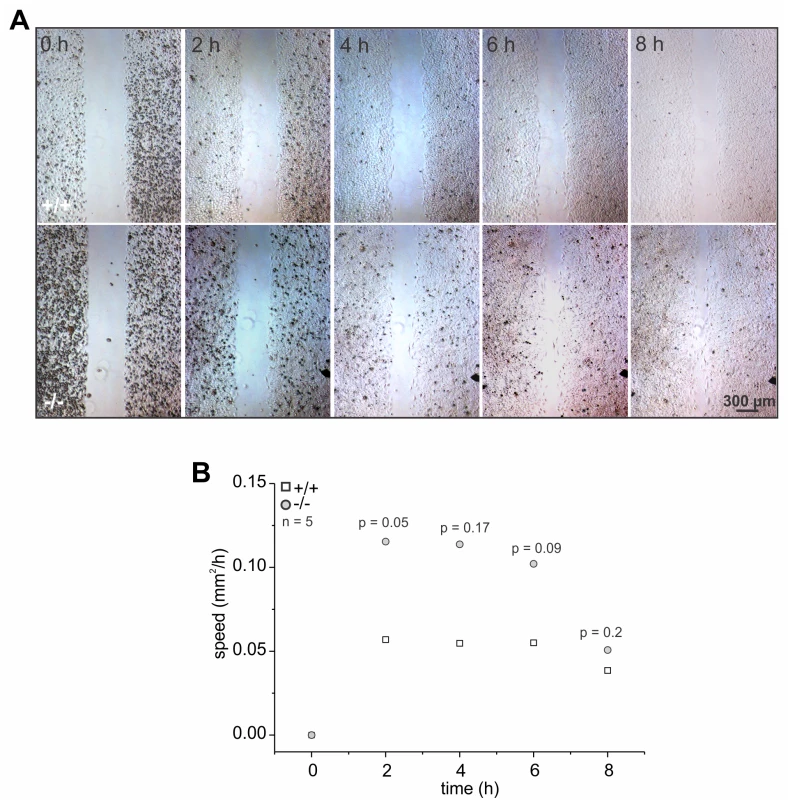 The absence of GBA2 affects cell migration.