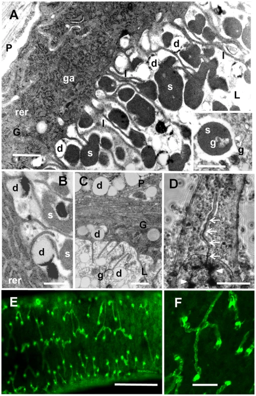 The gut and protonephridia.