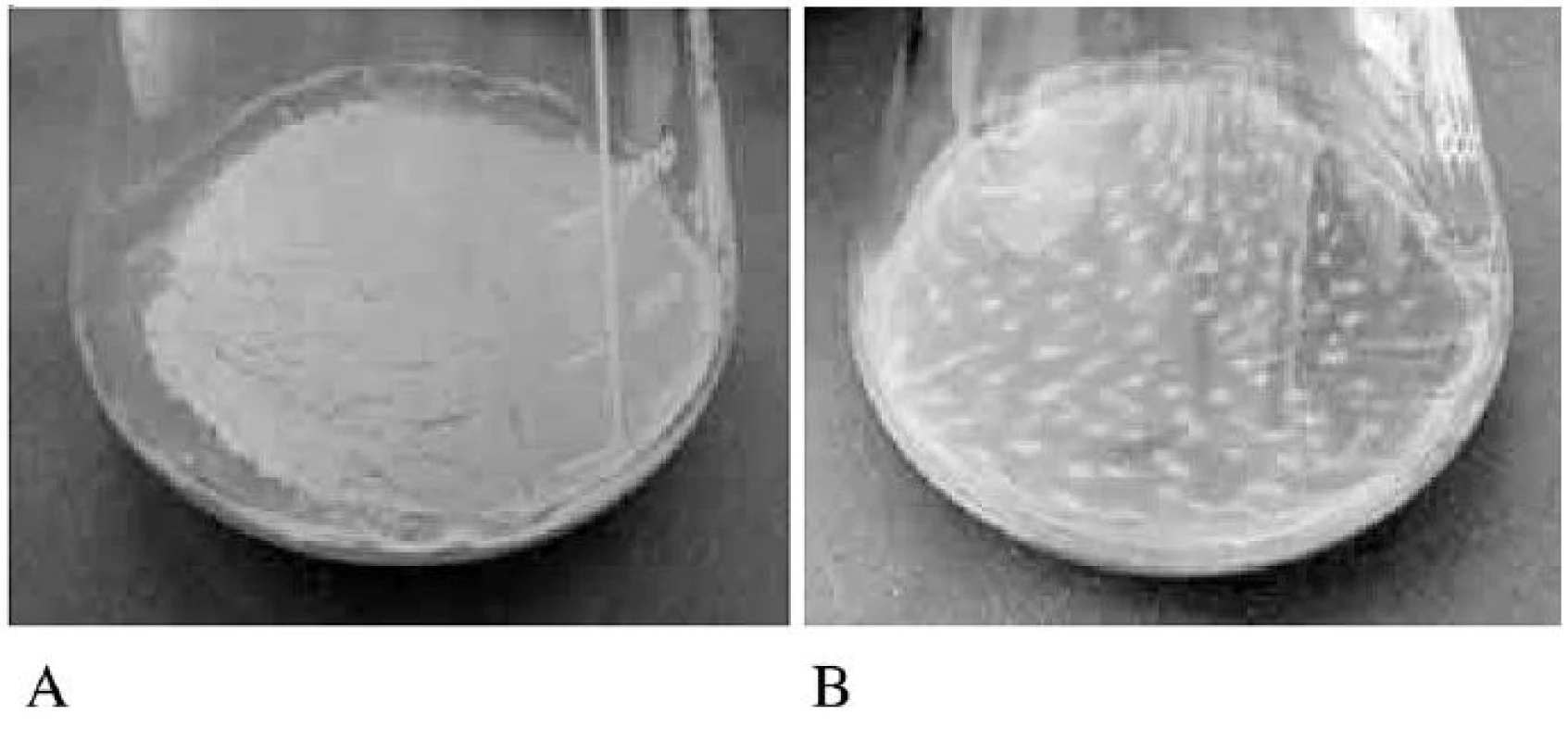 Aerovaný biofilm
A – kompaktní typ, B – vločkovitý typ

Fig. 3. Formation of aerated biofilm
A – compact biofilm, B – floccular biofilm