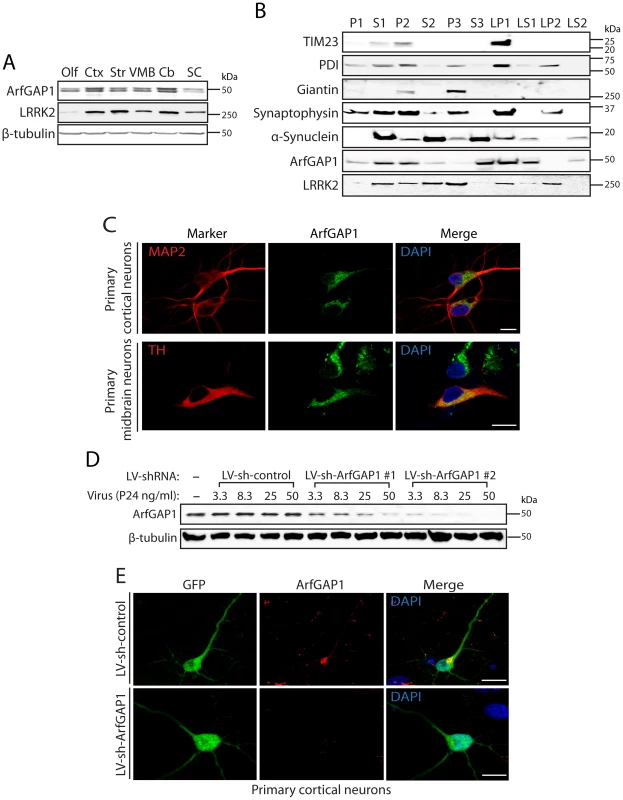 ArfGAP1 is expressed in the mammalian brain.