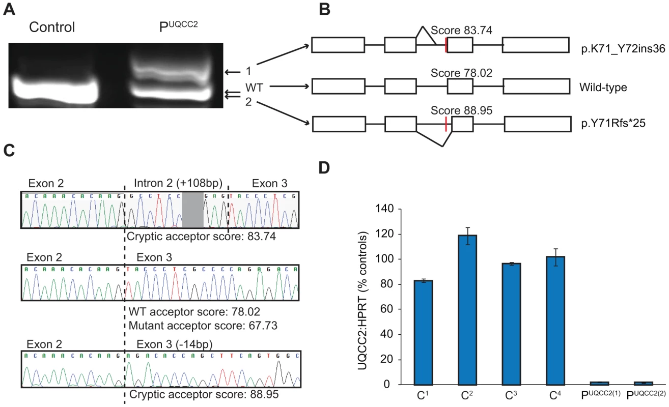 The c.214-3C>G mutation causes a severe <i>UQCC2</i> splicing defect.