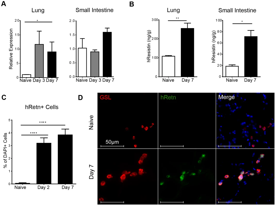 Detection of hResistin expression in <i>Nb</i>-infected transgenic mice.