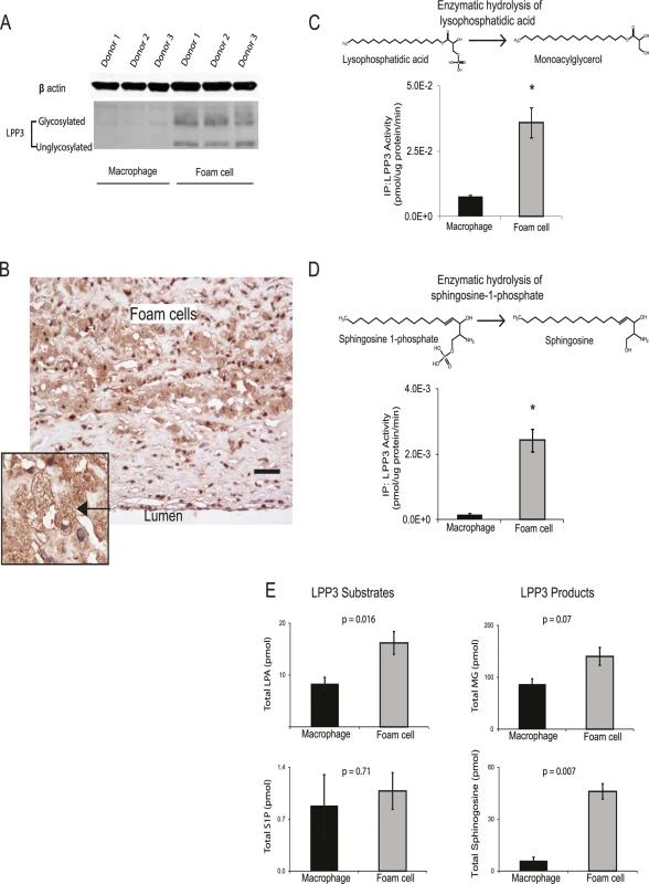 OxLDL exposure induces <i>PPAP2B</i>-encoded LPP3 expression and activity in foam cells.