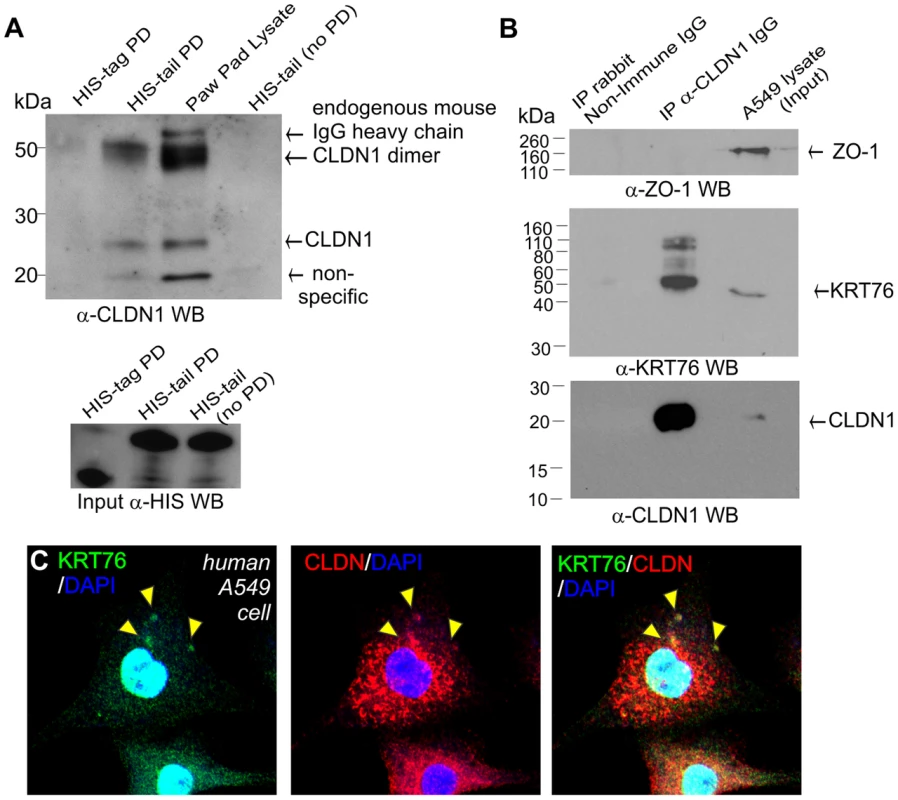 KRT76 interacts with Claudin1.
