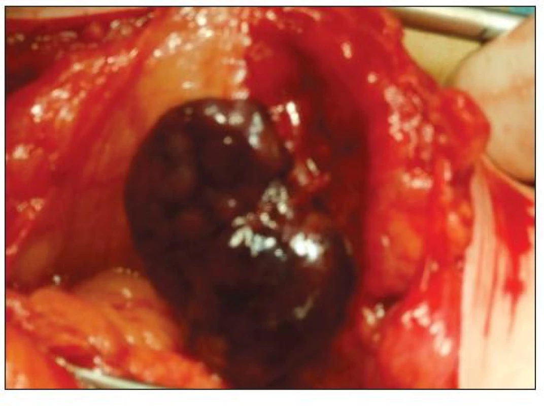 <br>Fig. 4.