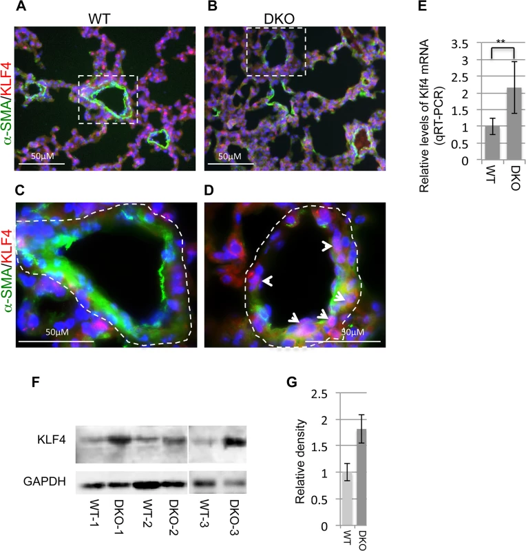 Upregulation of KLF4 in miR-29 null lungs.