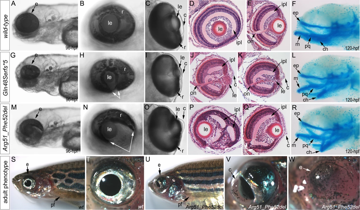 Phenotypic analysis of homozygous embryos carrying mutant <i>mab21l2</i> alleles encoding p.(Gln48Serfs*5) truncation (<i>mab21l2</i><sup>Q48Sfs*5</sup>) and p.(Arg51_Phe52del) in-frame deletion (<i>mab21l2</i><sup><i>R51_F52del</i></sup>) proteins.