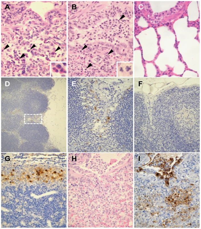 Pathological findings in ferrets infected with UT3062 or 3062(HA+NS).