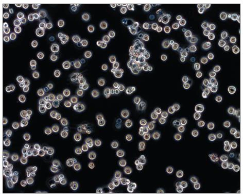 Soubor makrofágů v mikroskopu s fázovým kontrastem
Fig. 1. Population of macrophages in a phase contrast microscope