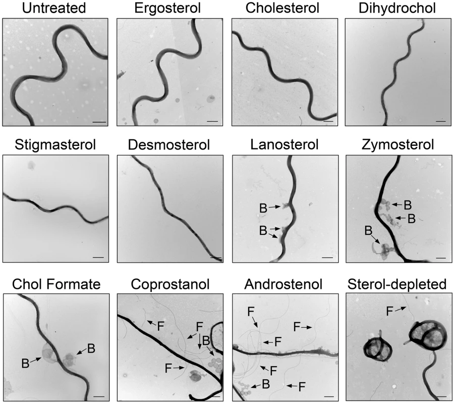 Effect of sterol substitution on the morphology of <i>B.</i> <i>burgdorferi</i>.