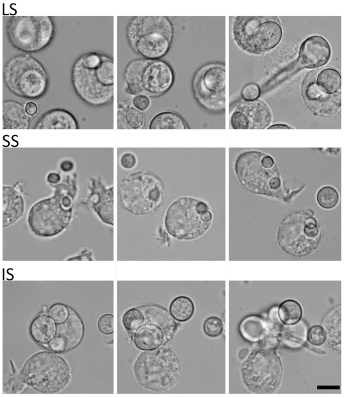 Time-lapse analysis of response of the murine macrophage to large spores (LS), small spores (SS), and isotropically grown spores (IS).