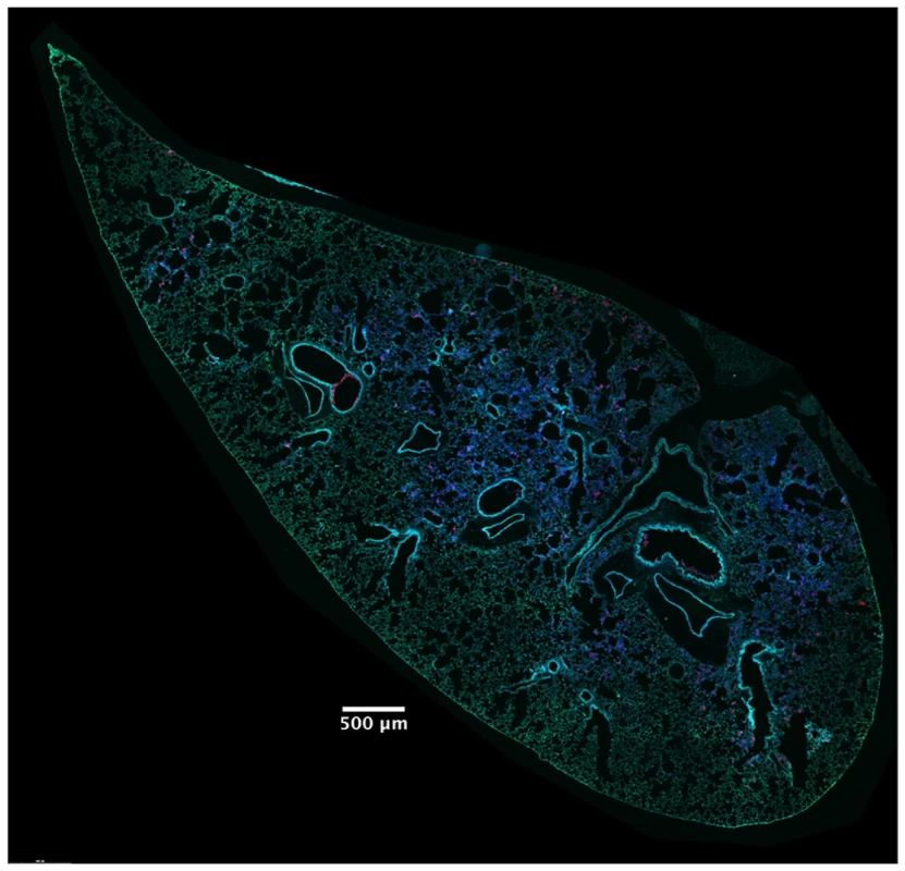 High concentrations of ExoS-injected cells occur in discrete regions within the lungs.