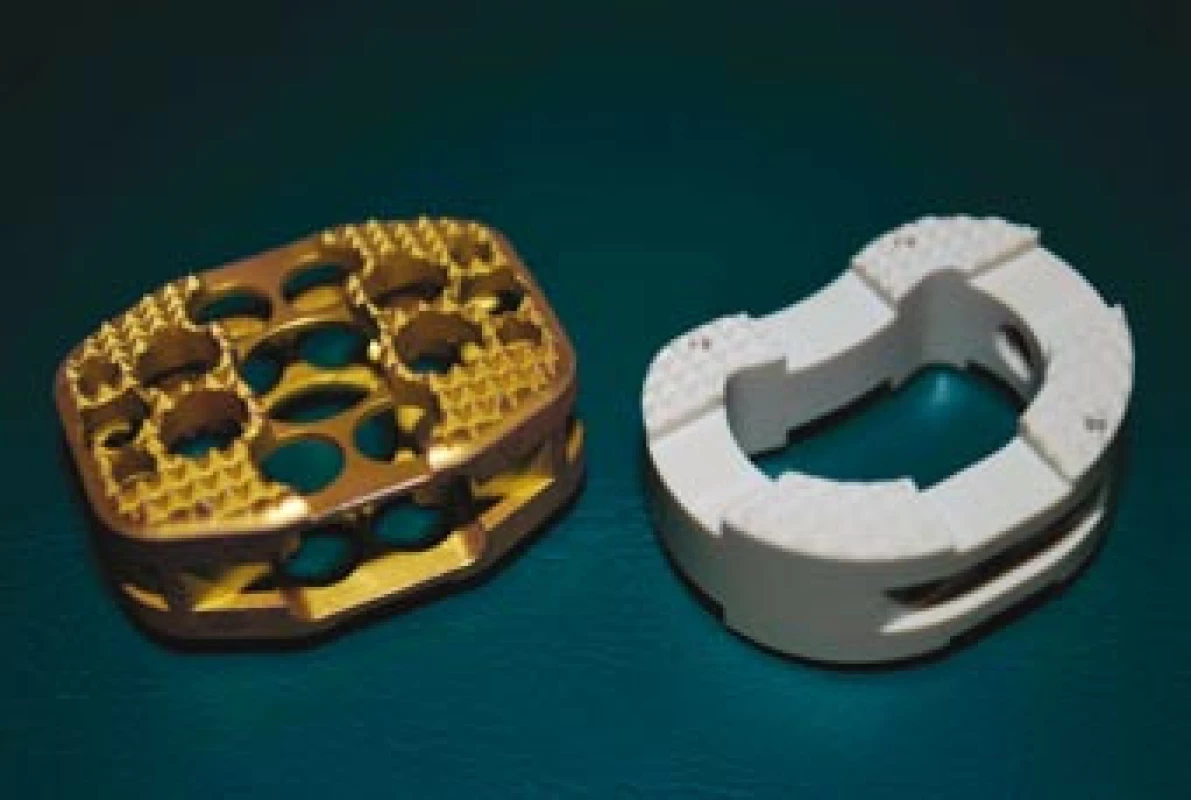 Vlevo na obrázku je titanový implantát SynCage (žlutý) a vpravo je PEEKový implantát Visios (bílý).