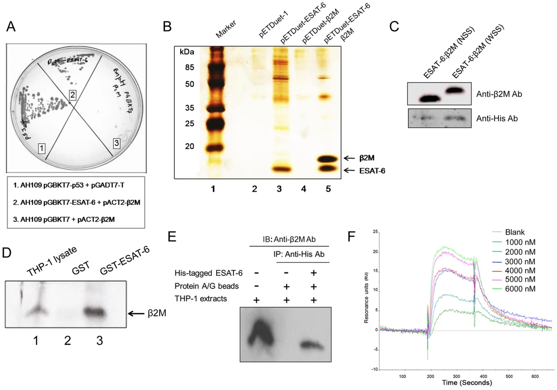 ESAT-6 protein interacts with β2M.