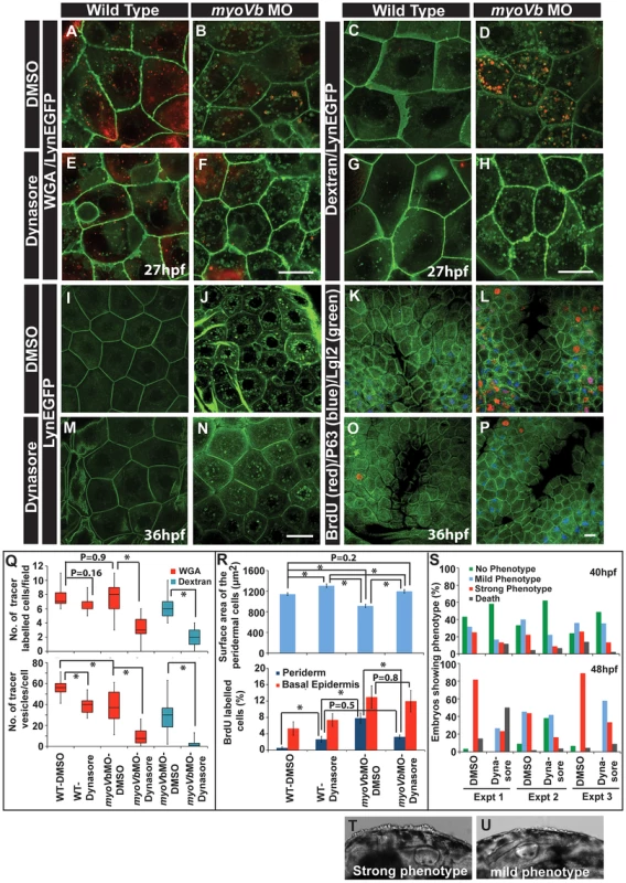 Reduction in endocytosis mitigates the cellular and morphological phenotype in Myosin Vb deficient embryos.